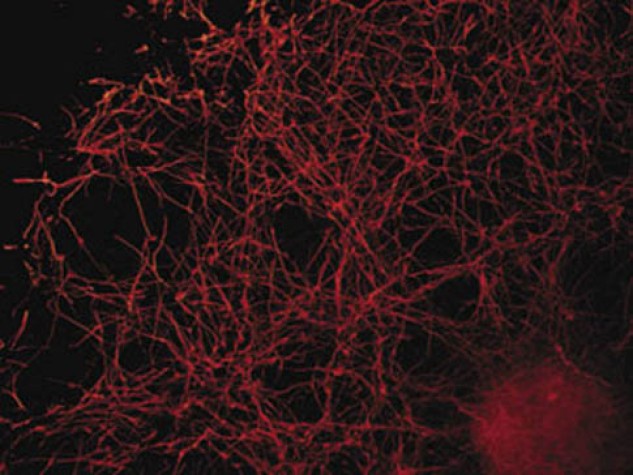 USP pesquisa molécula capaz de reverter a morte de células cerebrais