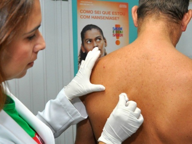 Médica faz exame da hanseníase em paciente sem camisa em Manaus